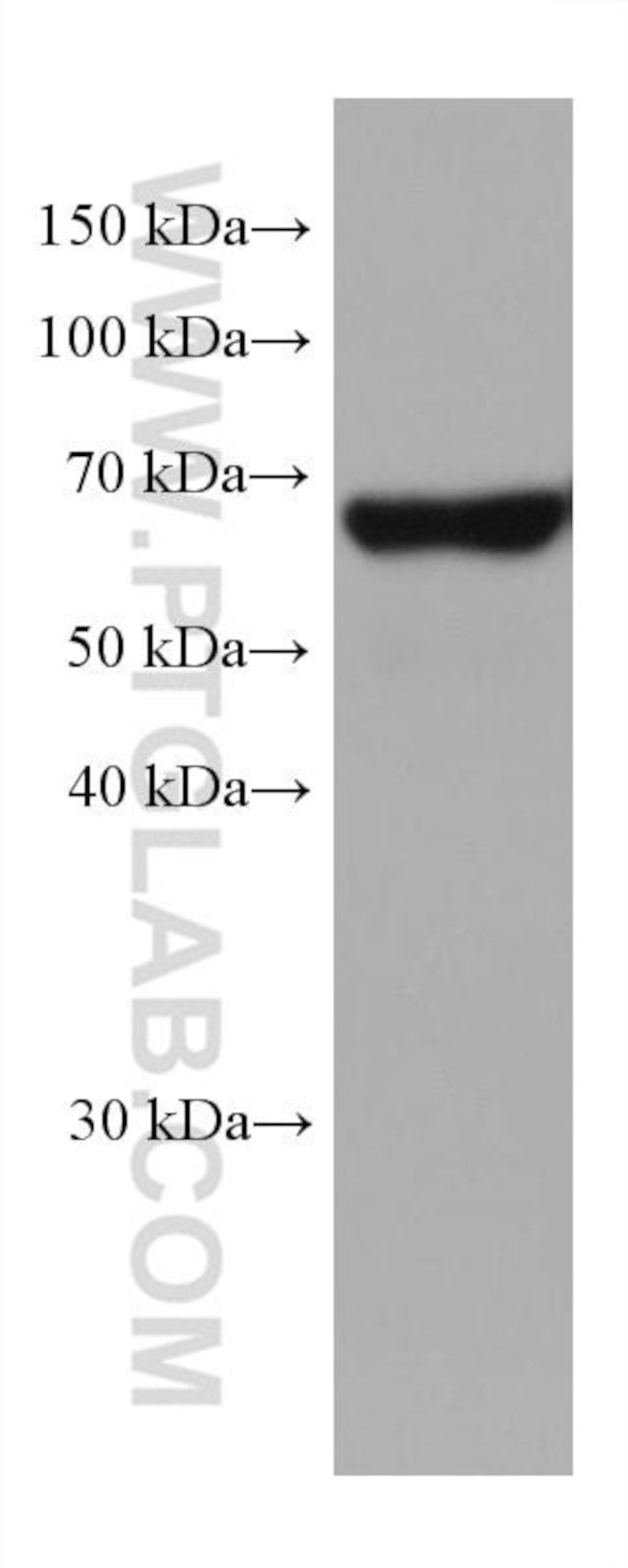 MFSD2 Antibody in Western Blot (WB)