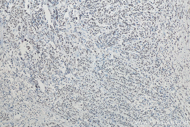 RALY Antibody in Immunohistochemistry (Paraffin) (IHC (P))