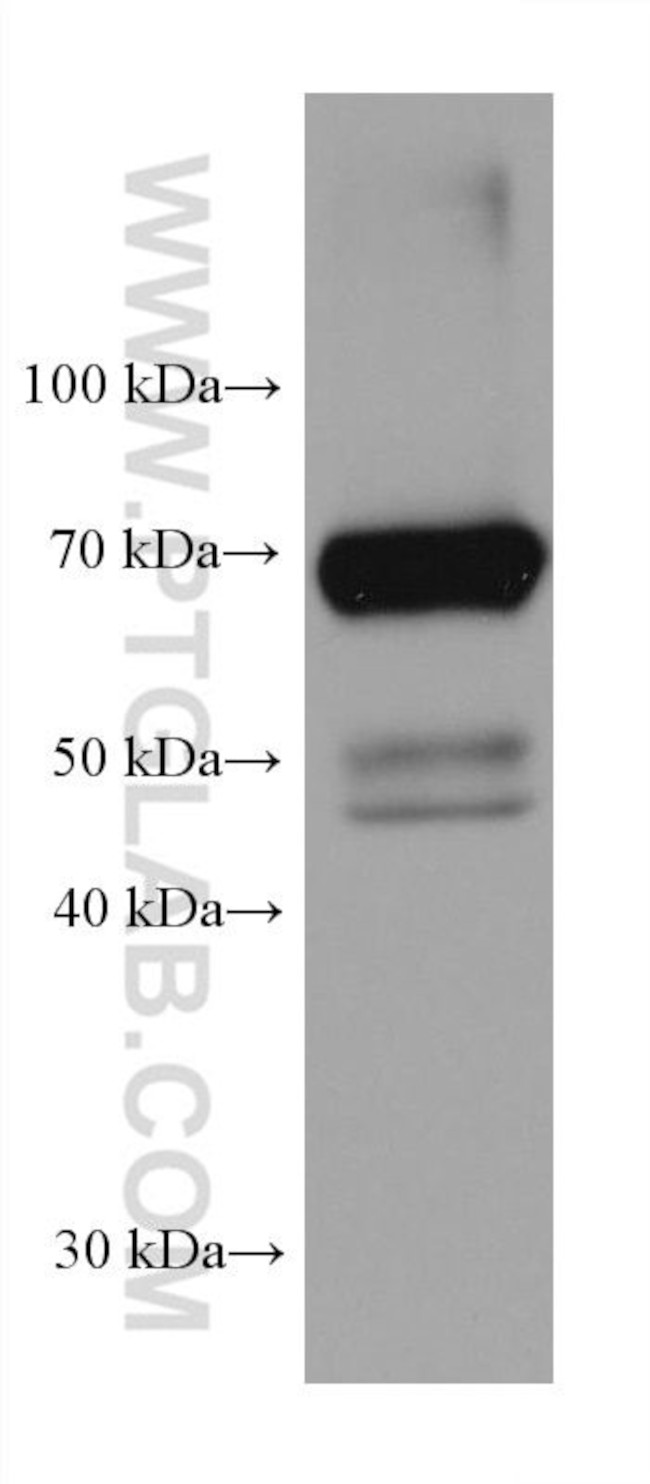 ACOX1 Antibody in Western Blot (WB)