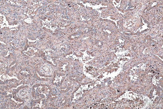 CRMP1 Antibody in Immunohistochemistry (Paraffin) (IHC (P))