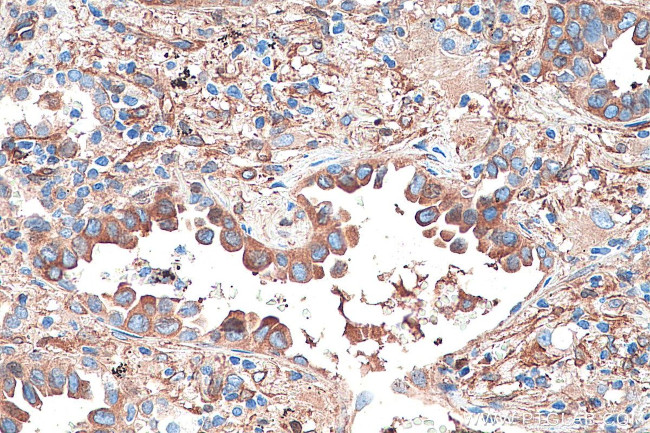 CRMP1 Antibody in Immunohistochemistry (Paraffin) (IHC (P))