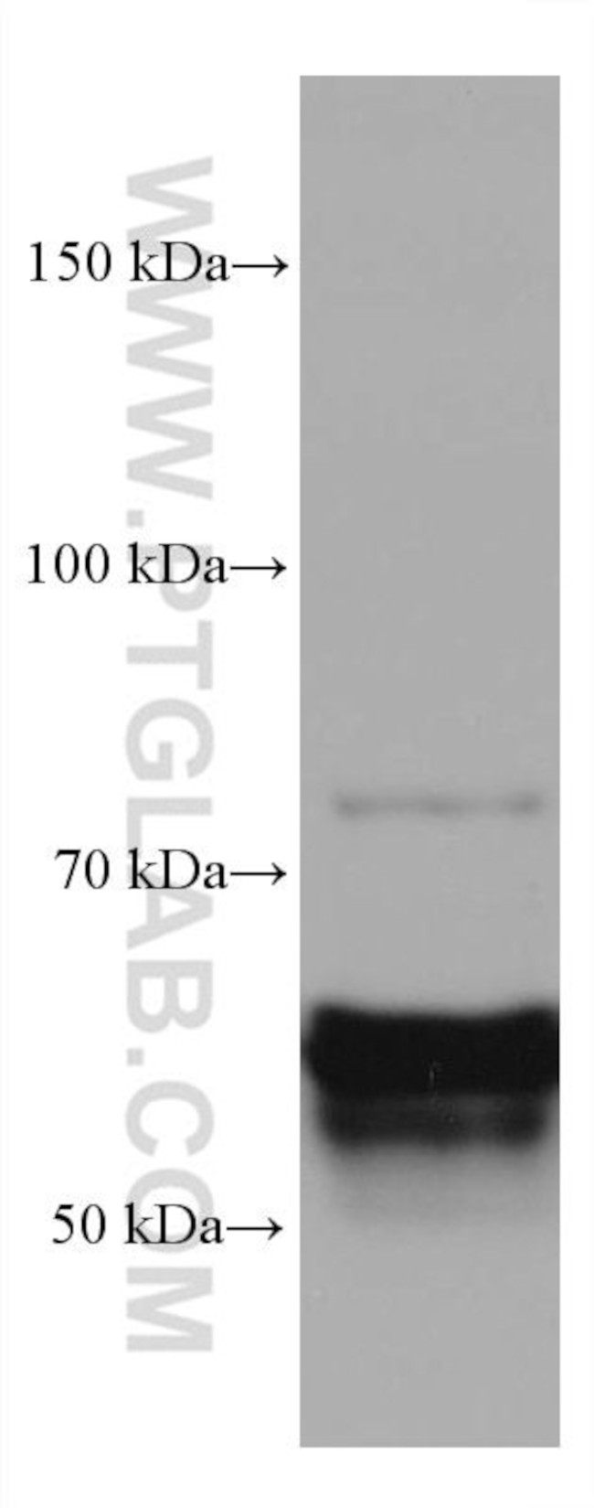 CRMP1 Antibody in Western Blot (WB)