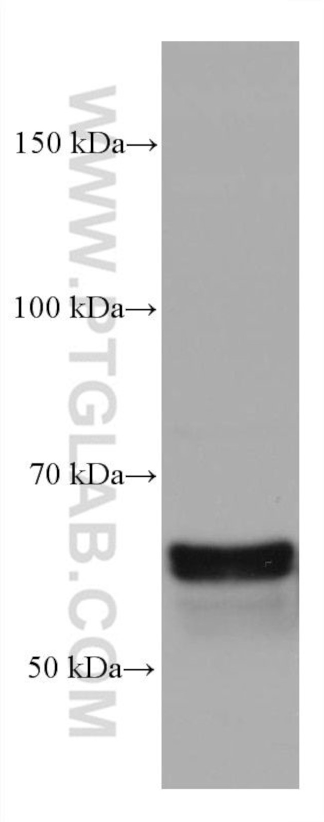 CRMP1 Antibody in Western Blot (WB)