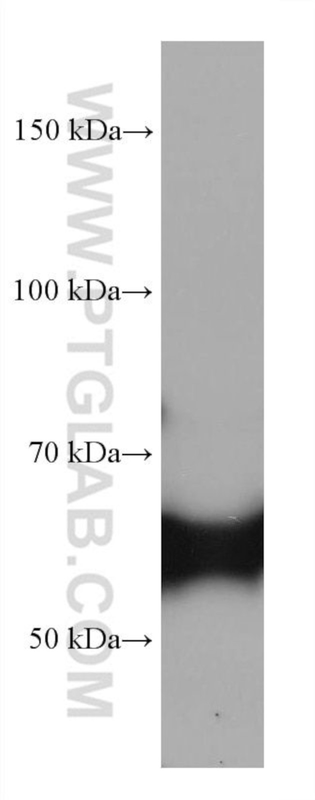 CRMP1 Antibody in Western Blot (WB)