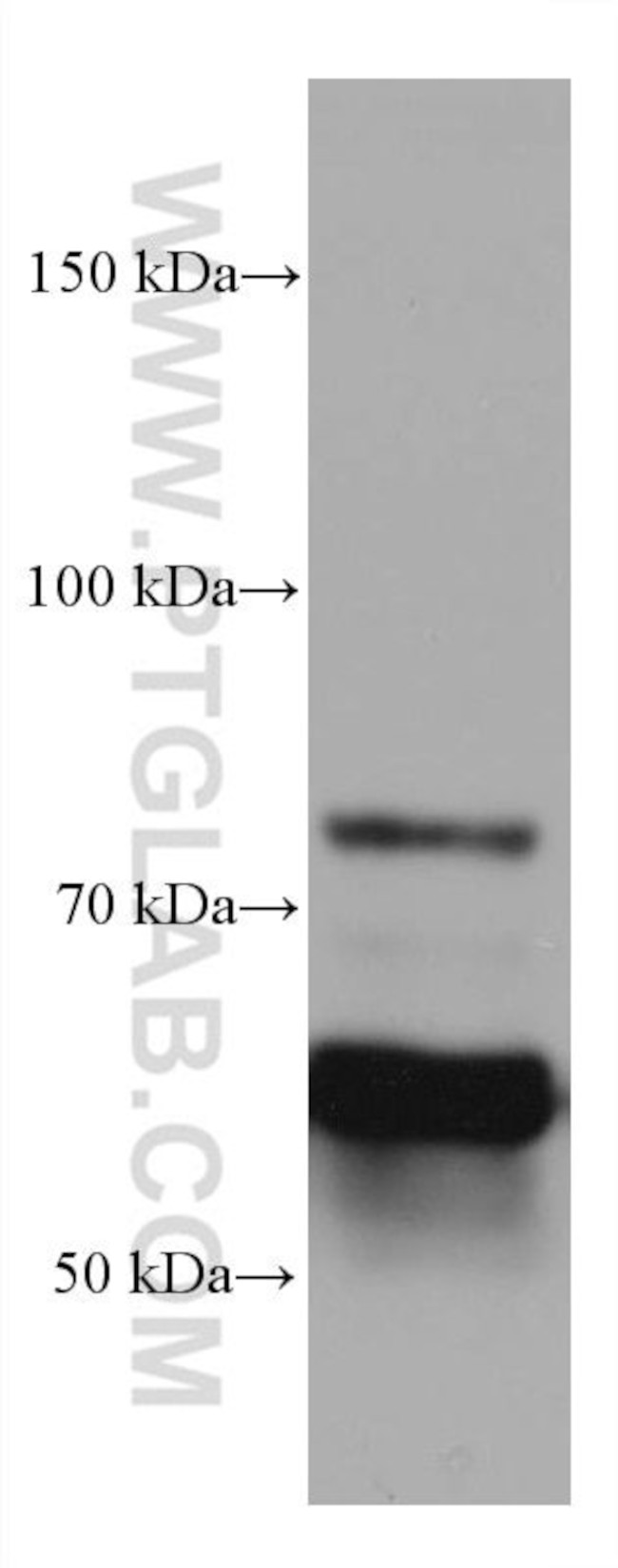 CRMP1 Antibody in Western Blot (WB)