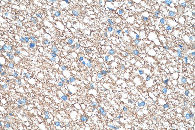 GNAO1 Antibody in Immunohistochemistry (Paraffin) (IHC (P))