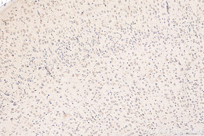 FTL Antibody in Immunohistochemistry (Paraffin) (IHC (P))