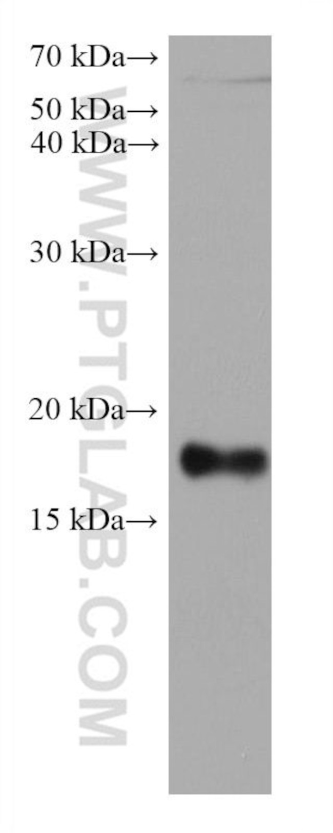 FTL Antibody in Western Blot (WB)