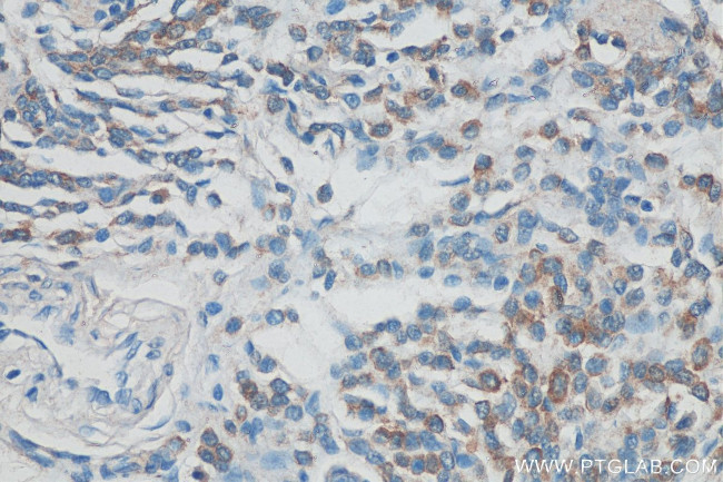 Syntenin-1 Antibody in Immunohistochemistry (Paraffin) (IHC (P))