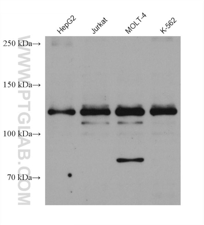 LPIN1 Antibody in Western Blot (WB)