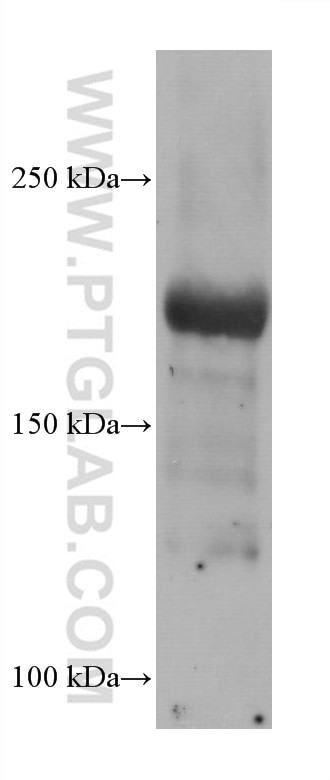 SCN5A Antibody in Western Blot (WB)