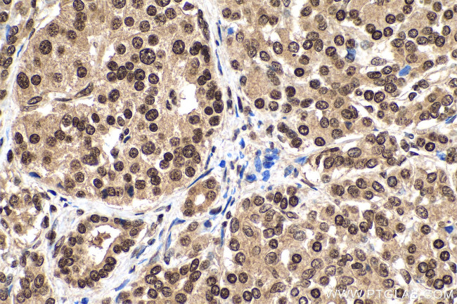 m7G Antibody in Immunohistochemistry (Paraffin) (IHC (P))