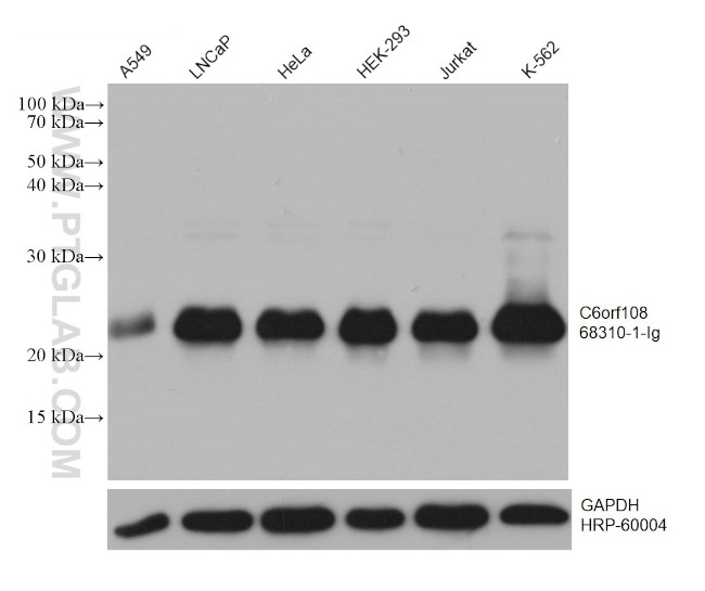 C6orf108 Antibody in Western Blot (WB)