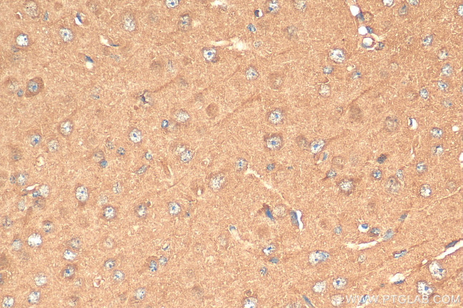 CCS Antibody in Immunohistochemistry (Paraffin) (IHC (P))