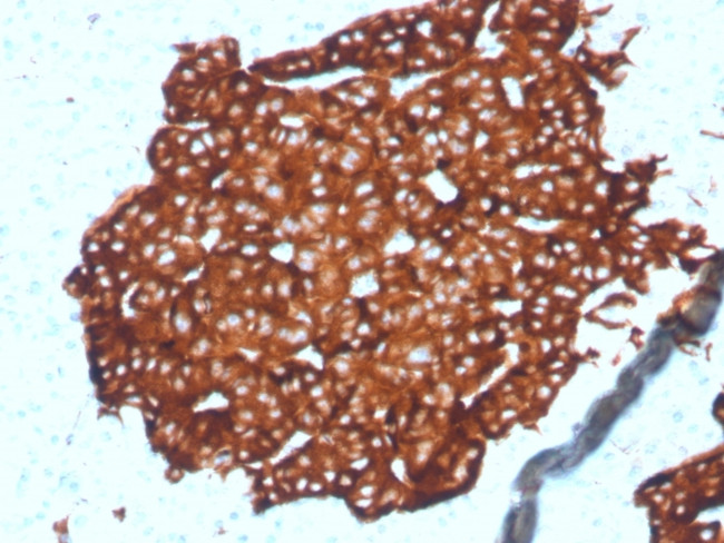 Synaptophysin (Neuroendocrine Marker) Antibody in Immunohistochemistry (Paraffin) (IHC (P))