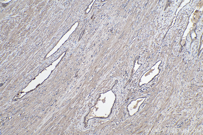 TGF beta 1 Antibody in Immunohistochemistry (Paraffin) (IHC (P))