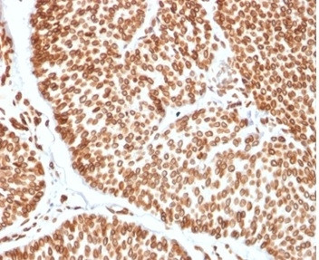 TCF4 (Transcription Factor 4) Antibody in Immunohistochemistry (Paraffin) (IHC (P))