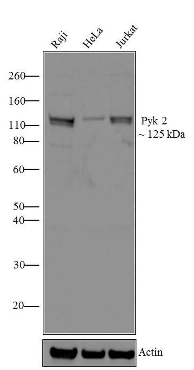 PYK2 Antibody in Western Blot (WB)