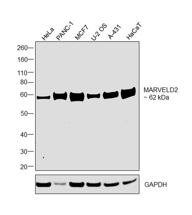 MARVELD2 Antibody in Western Blot (WB)