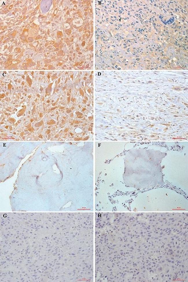 Phospho-FAK (Tyr397) Antibody in Immunohistochemistry (Paraffin) (IHC (P))