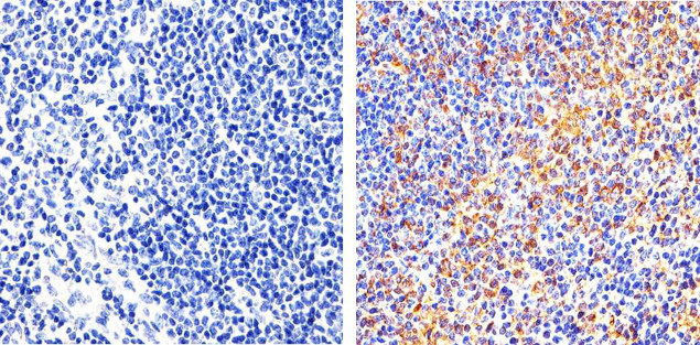 Phospho-FAK (Tyr397) Antibody in Immunohistochemistry (Paraffin) (IHC (P))