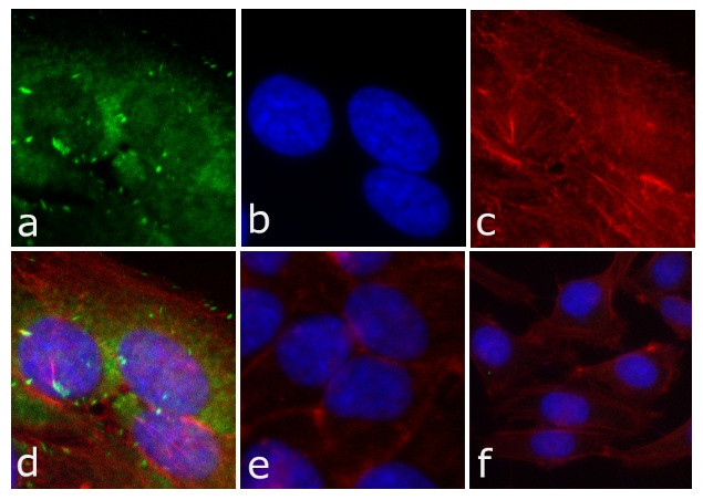 Phospho-FAK (Tyr397) Antibody in Immunocytochemistry (ICC/IF)