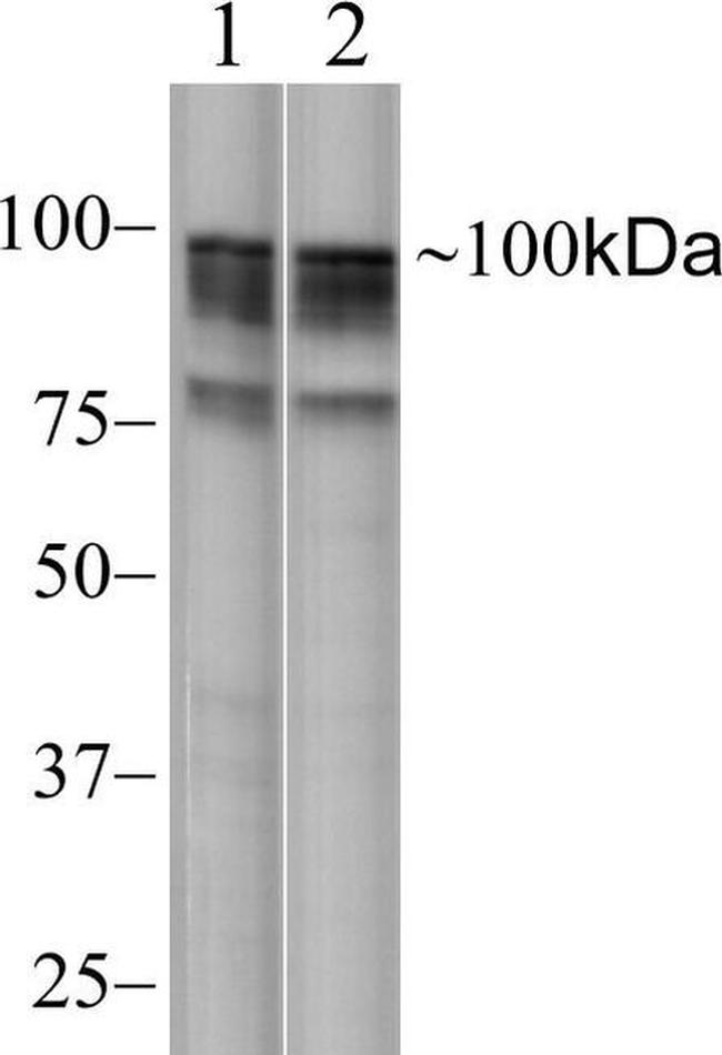 NIK Antibody in Western Blot (WB)