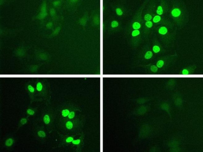 Phospho-STAT1 (Tyr701) Antibody in Immunocytochemistry (ICC/IF)