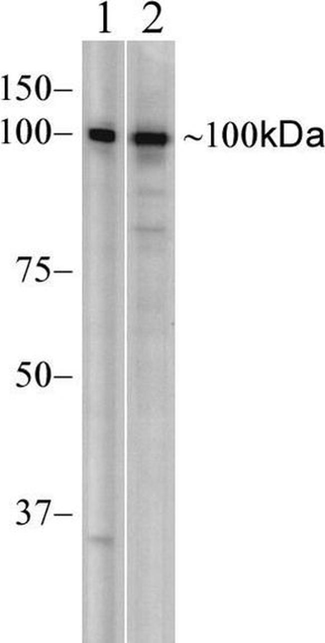 MDA5 Antibody in Western Blot (WB)