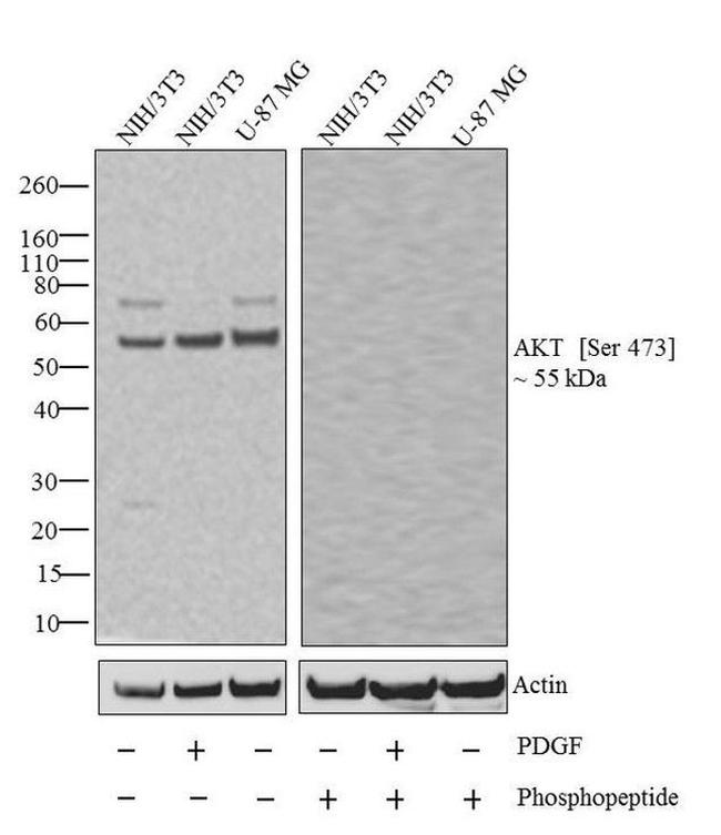 Phospho-AKT1 (Ser473) Recombinant Monoclonal Antibody (98H9L8 