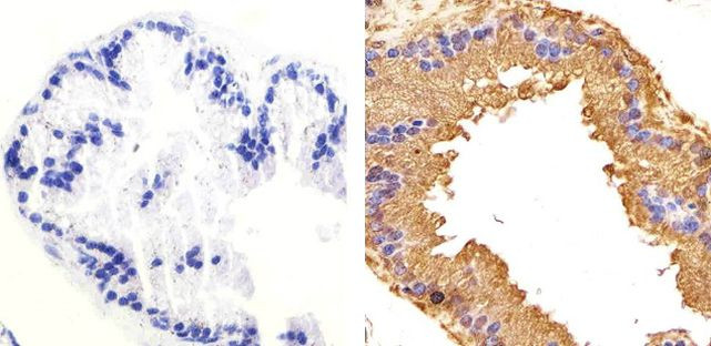 Phospho-GSK3B (Ser9) Antibody in Immunohistochemistry (Paraffin) (IHC (P))