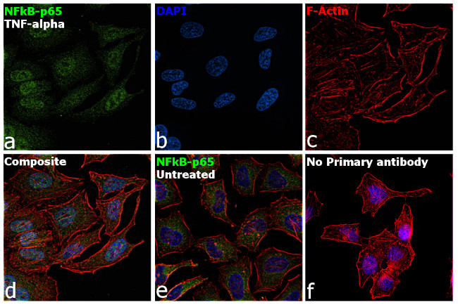 NFkB p65 Antibody in Immunocytochemistry (ICC/IF)