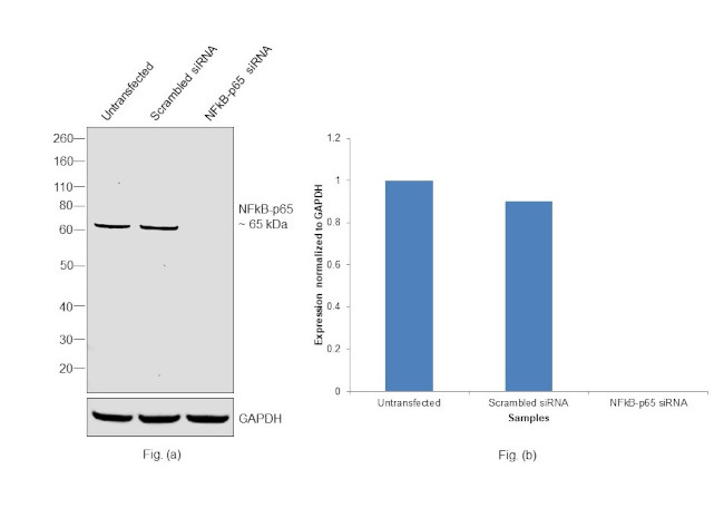 NFkB p65 Antibody