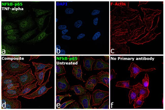 NFkB p65 Antibody