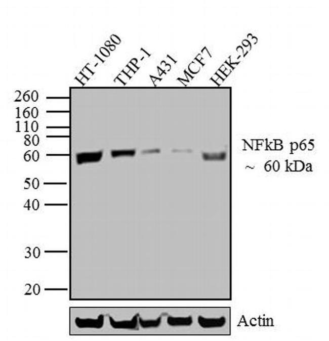 NFkB p65 Antibody in Western Blot (WB)