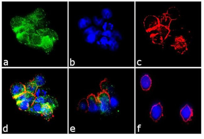 CXCL9 Recombinant Rabbit Monoclonal Antibody (11H1L14)