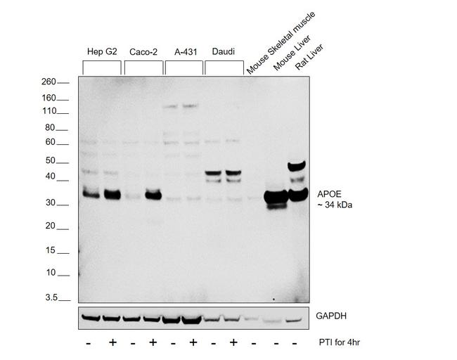 APOE Recombinant Rabbit Monoclonal Antibody (16H22L18)