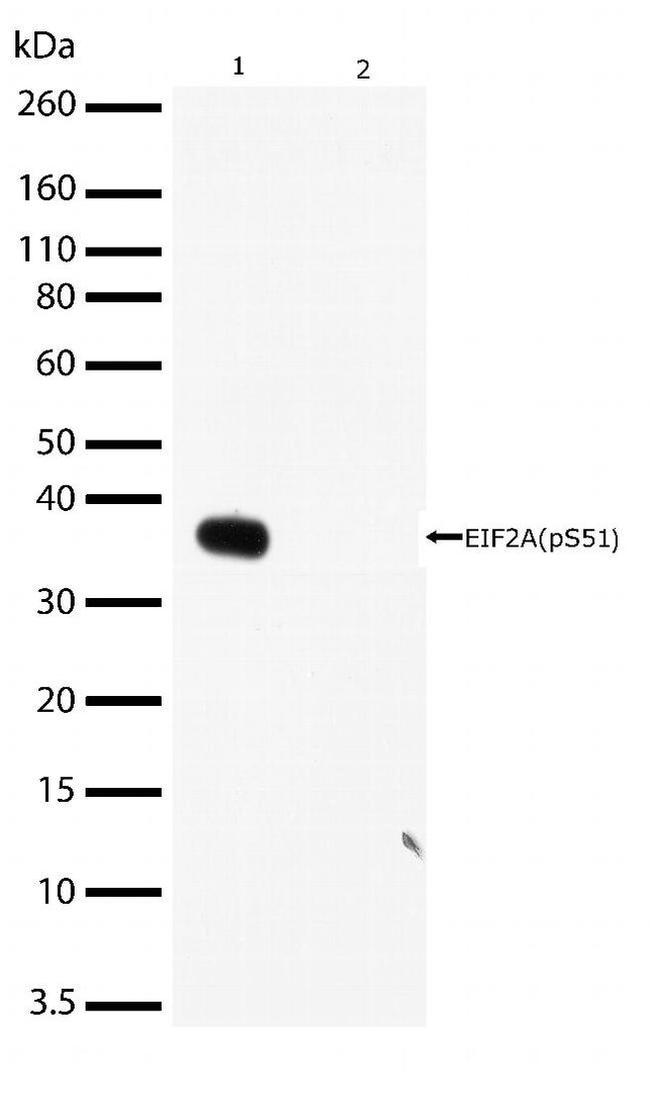 Phospho-EIF2S1 (Ser51) Antibody