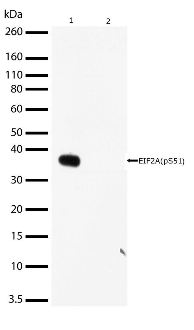 Phospho-EIF2S1 (Ser51) Antibody in Western Blot (WB)