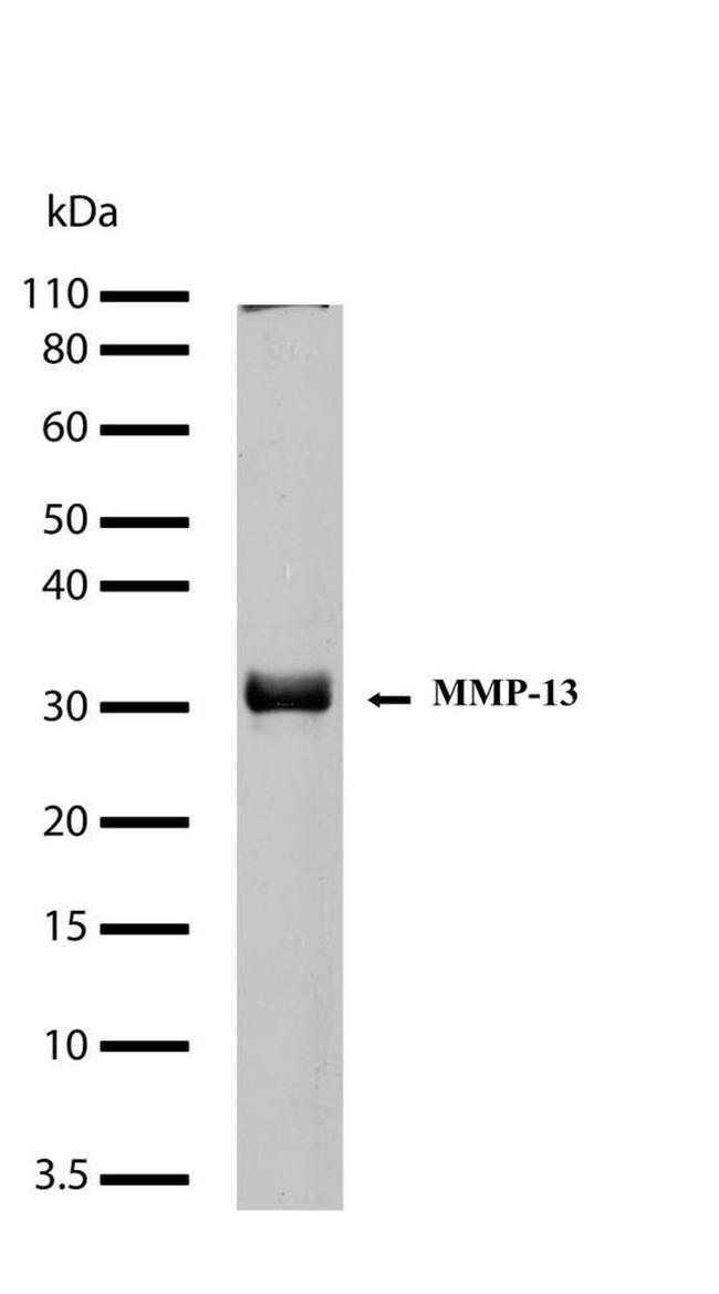 MMP13 Antibody in Western Blot (WB)