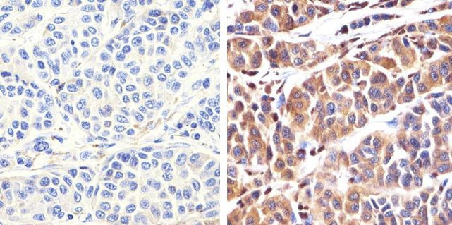 S100B Antibody in Immunohistochemistry (Paraffin) (IHC (P))