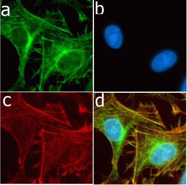 CD56 Antibody in Immunocytochemistry (ICC/IF)