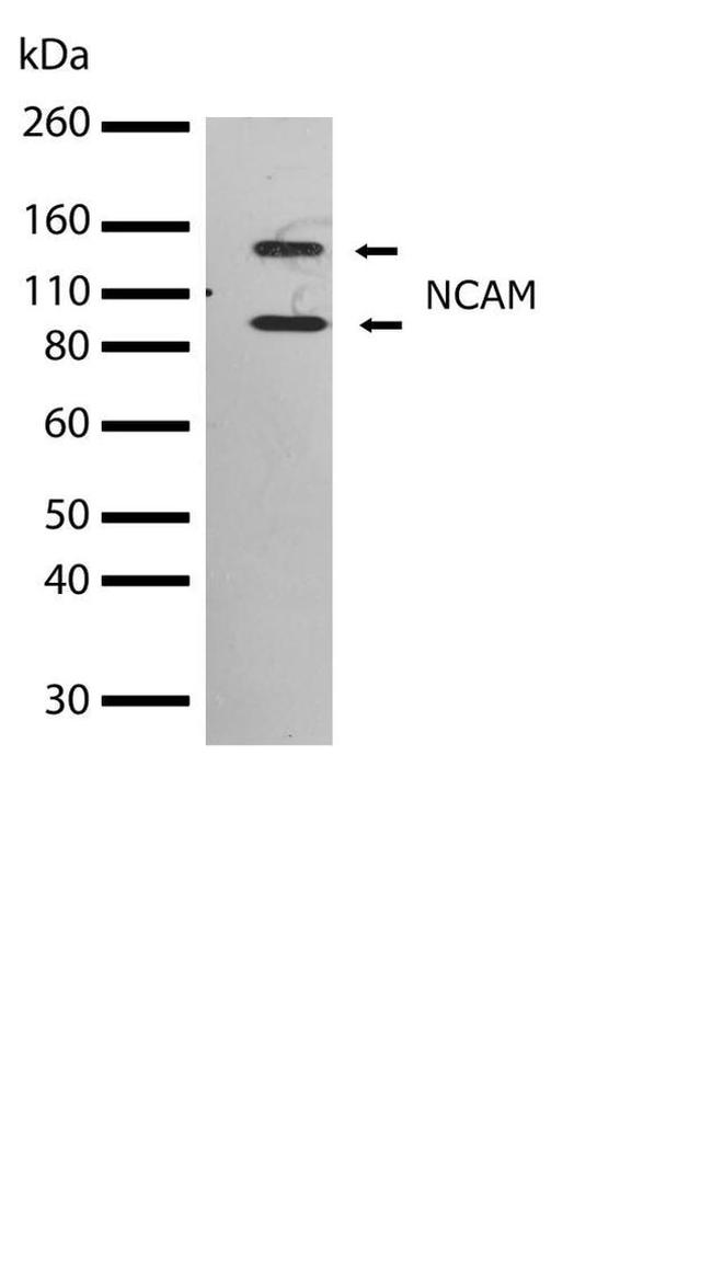 CD56 Antibody in Western Blot (WB)