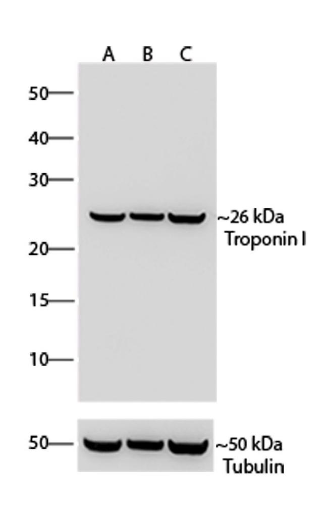 Troponin I Recombinant Monoclonal Antibody (1H11L19) (701585)