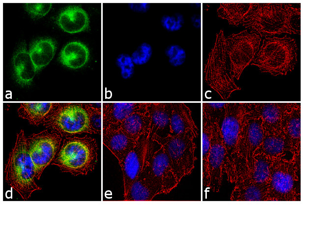 Phospho-CDK1 (Thr14, Tyr15) Antibody in Immunocytochemistry (ICC/IF)