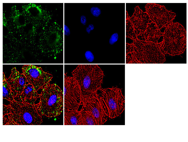 SMAD7 Antibody in Immunocytochemistry (ICC/IF)