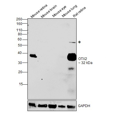 OTX2 Recombinant Monoclonal Antibody (14H14L5) (701948)