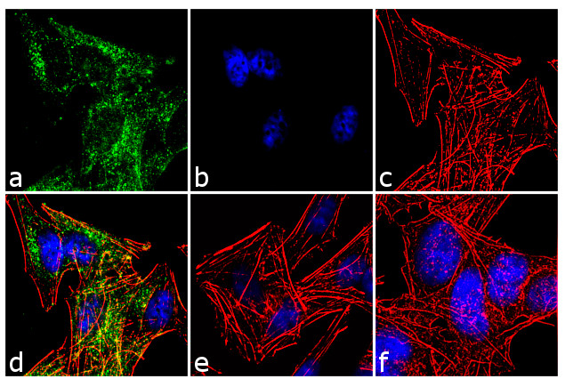 TrkC Antibody in Immunocytochemistry (ICC/IF)