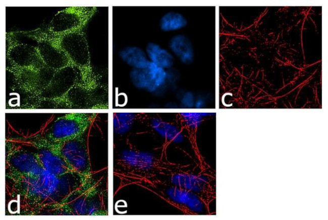 SLC6A4 Antibody in Immunocytochemistry (ICC/IF)