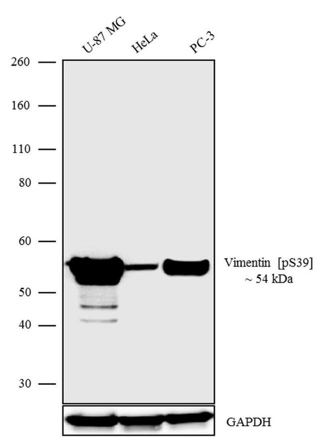 Phospho-Vimentin (Ser39) Antibody in Western Blot (WB)